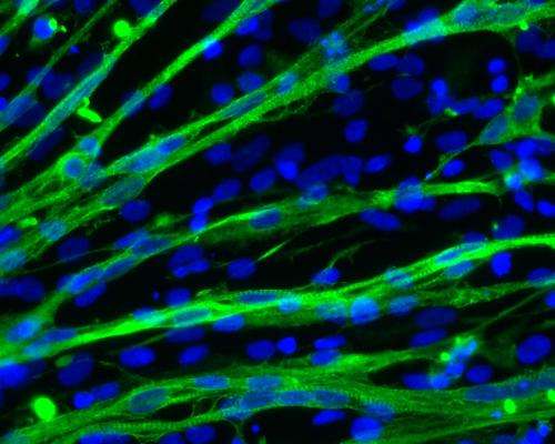 A new way to make muscle cells from human stem cells