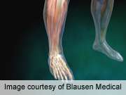 糖尿病神经病变患者的踝关节、膝关节力量产生较慢
