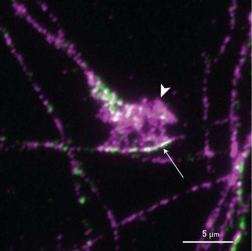 A single protein activates the machinery needed for axon growth and holds the axons together for collective extension