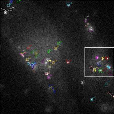 Automatic tracking of biological particles in cell microscopy images