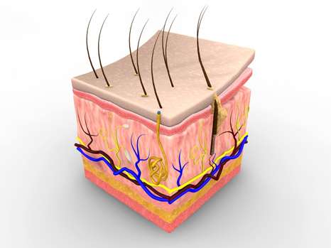 Avoiding skin graft rejection: It's possible!