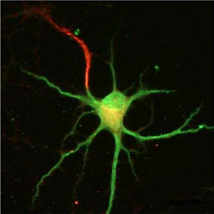 Axons growing out of dendrites? Neuroscientists hate when that happens