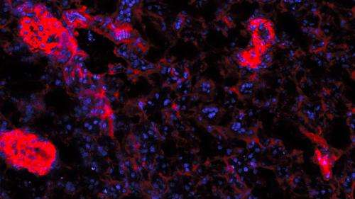 B-cells aggravate autoimmune diseases