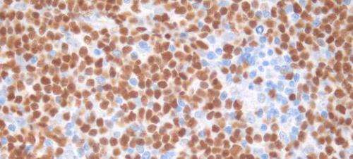 Big data to help blood cancer patients