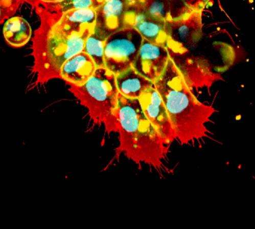 Blocking cells' movement to stop the spread of cancer