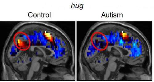 Brain representations of social thoughts accurately predict autism diagnosis