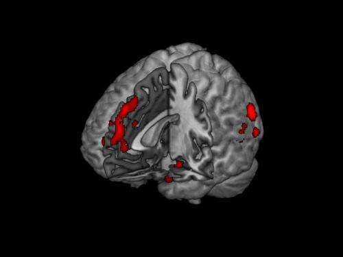 Brain scans link concern for justice with reason, not emotion