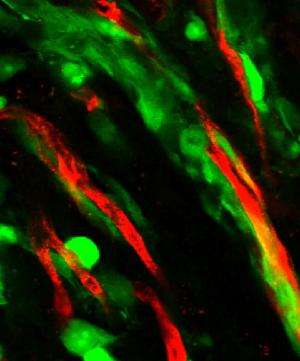 Brain tumor invasion along blood vessels may lead to new cancer treatments