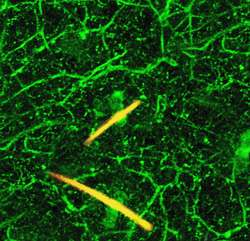 Brain uses serotonin to perpetuate chronic pain signals in local nerves