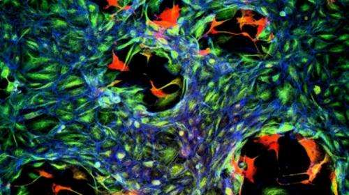 Cancer’s growth driven by minority of cells within a tumour