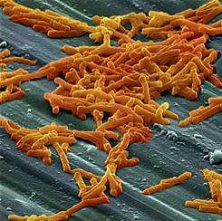Can probiotics reduce the severity of C. difficile infections?