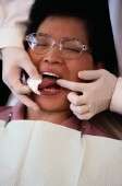 CDC: oral health in young women needs improvement