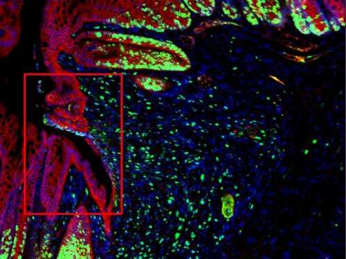 Cell stress inflames the gut