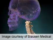 Cervical spine clearance protocols vary considerably