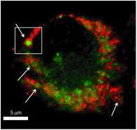 Chemical probe profiles live-cell organelle activity, adds to understanding of lysosome dynamics