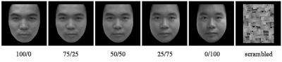 Chinese researchers describe impaired self-face recognition in those with major depressive disorder