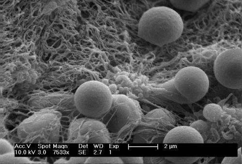 Clot-building nanoparticles raise survival rate following blast trauma