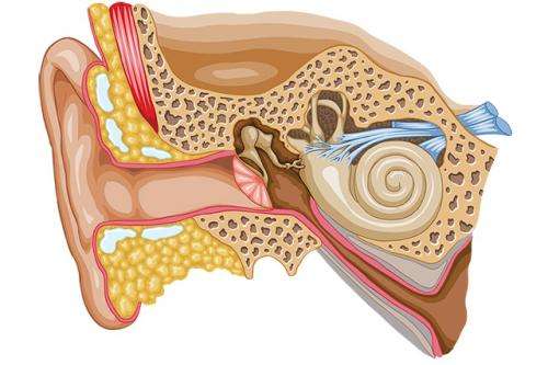 Cochlear implants—with no exterior hardware