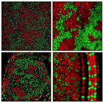 Color-coded cells reveal patchwork patterns of X chromosome silencing in female brains