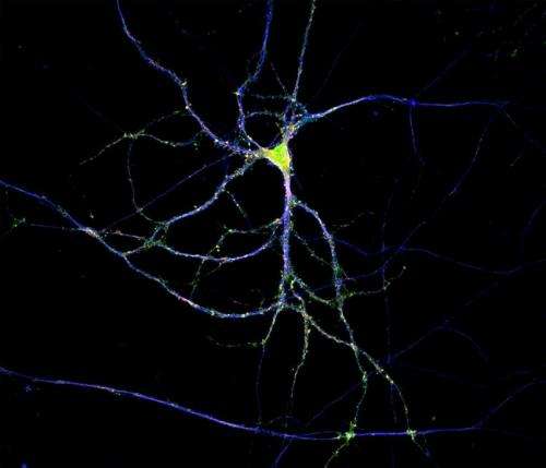 Control of Secretory Trafficking in Neurons