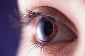 一项小型研究表明，眼部整容手术可以缓解偏头痛
