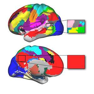Damage to brain 'hubs' causes extensive impairment