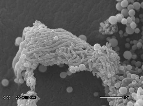 Deadly human pathogen Cryptococcus fully sequenced