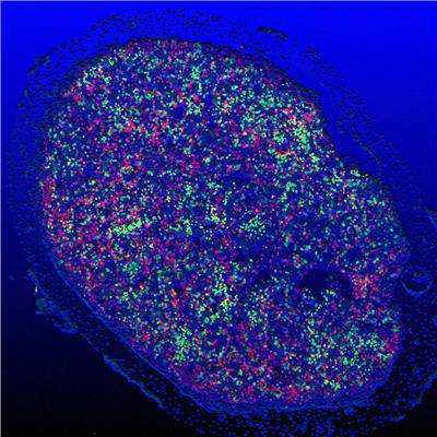 Defect in Ikaros gene mimics human B cell leukemia