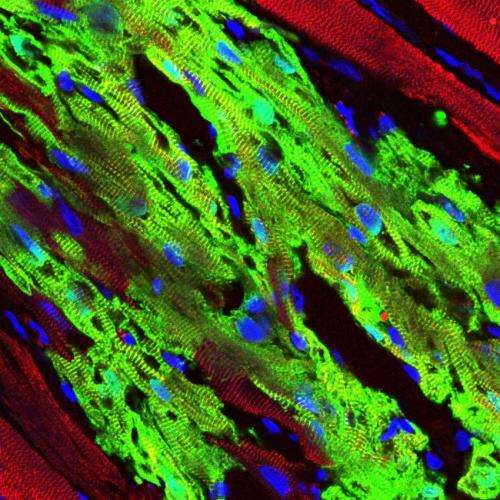 Stem cell therapy regenerates heart muscle damaged from heart attacks in primates