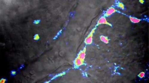Scientists catch brain damage in the act (w/ video)