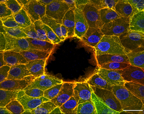 Discovery about wound healing key to understanding cell movement