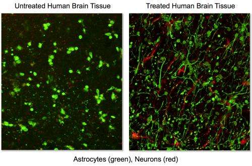 Discovery leads to patent for novel method of treating traumatic brain injury