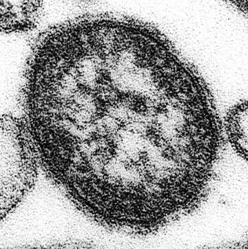 Discovery reveals how measles and Nipah viruses elude immune detection and activation