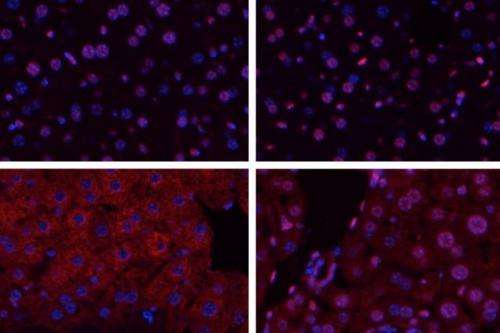 DNA repair enzyme can worsen tissue damage caused by stroke and organ transplantation