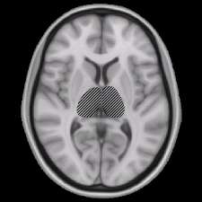 Enriched environments hold promise for brain injury patients