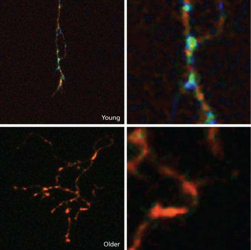Enzymes linked to cell death play key role in structural dynamics of neuronal axons