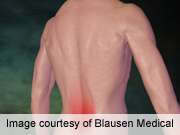 缺乏长期阿片类药物在低腰疼痛中使用的证据