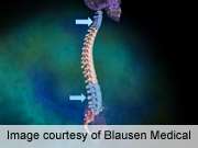 Factors tied to neck, back pain improvement identified
