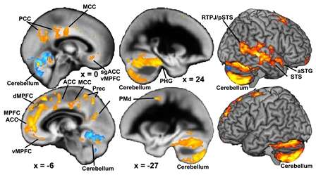 Family problems experienced in childhood and adolescence affect brain development