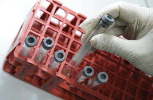 File photo of blood samples from an HIV screening test