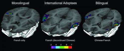 Finding 'lost' languages in the brain