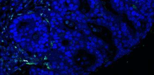 First of new generation of cancer drugs granted European approval