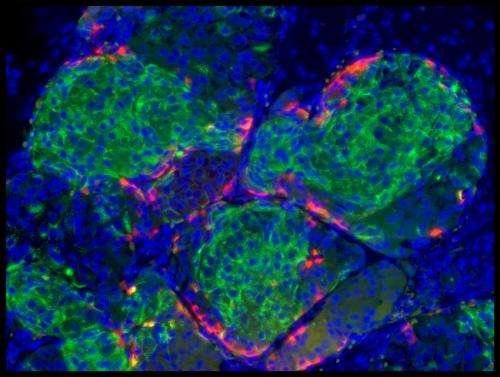 From human embryonic stem cells to billions of human insulin producing cells