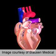 Gel implant might help fight heart failure