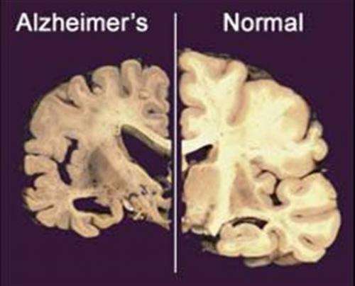 Genentech Alzheimer's drug misses goals in studies