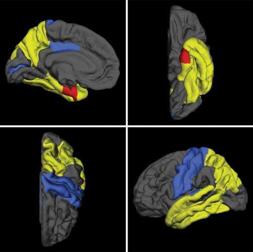 Gene variation associated with brain atrophy in mild cognitive impairment