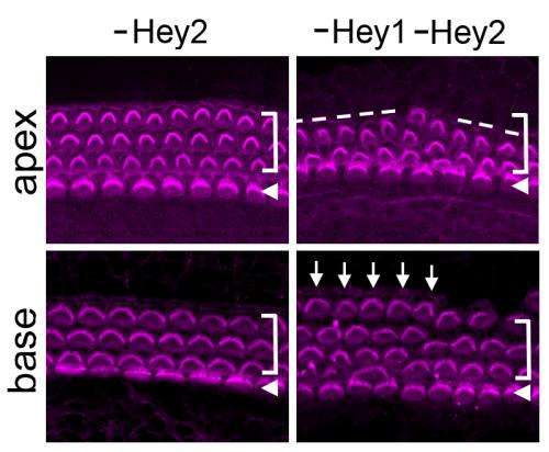 Hey1 and Hey2 ensure inner ear 'hair cells' are made at the right time, in the right place