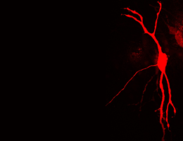 How nerve cells flexibly adapt to acoustic signals