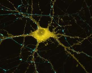 我们的大脑是如何一个细胞一个细胞地储存近期记忆的