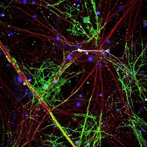 How the brain makes myelination activity-dependent